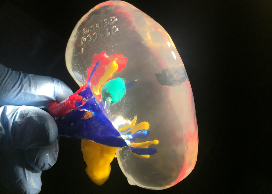 Tumours, Transplants & Technology: AI For Life