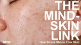 How Your Brain Affects Your Skin