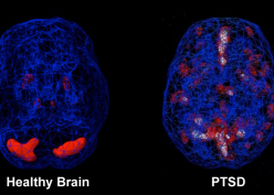 Uncovering the Story: PTSD Among Journalists